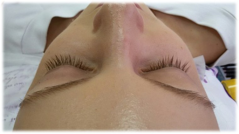 Промыть ресницы мыльной водой (пенкой, минцеряркой)