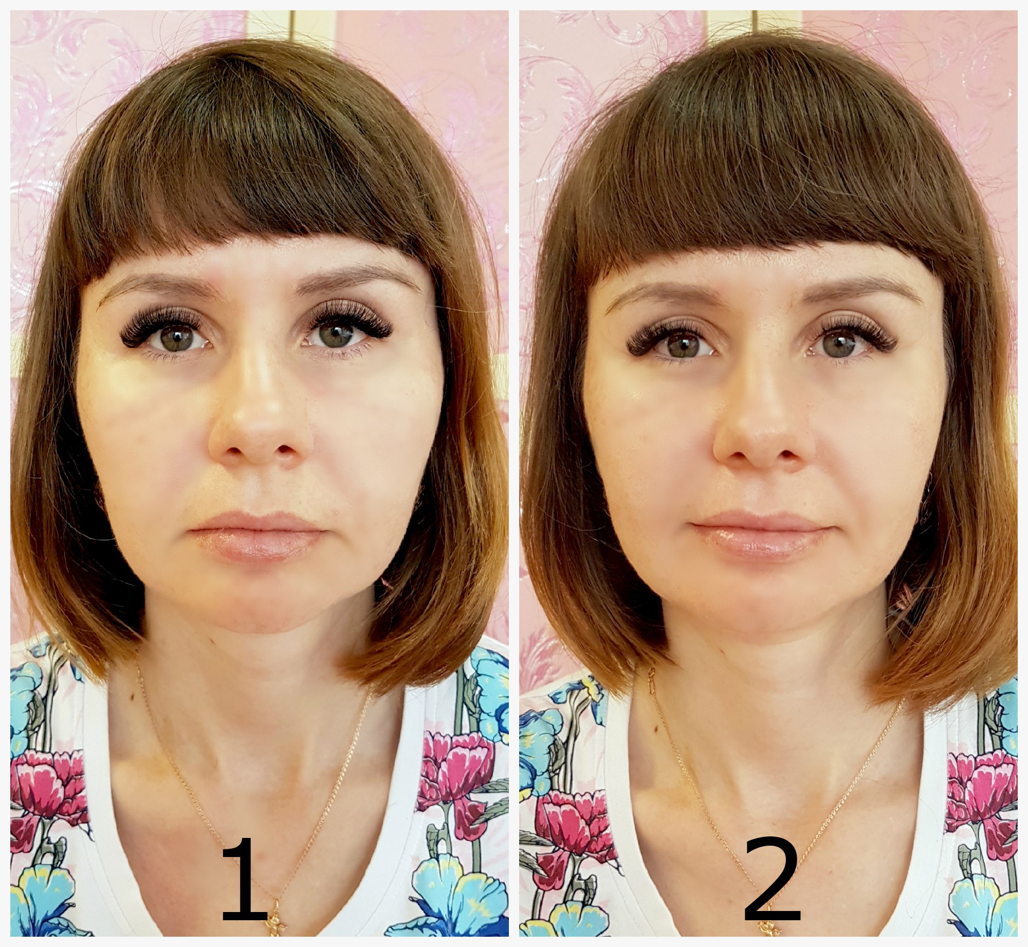 Близко посажанные глаза