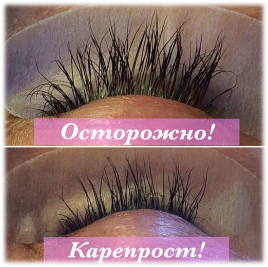 Карепрост